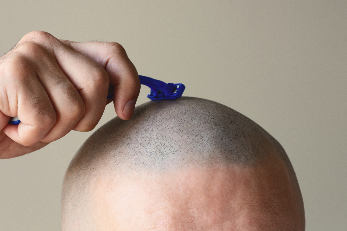 shaved head